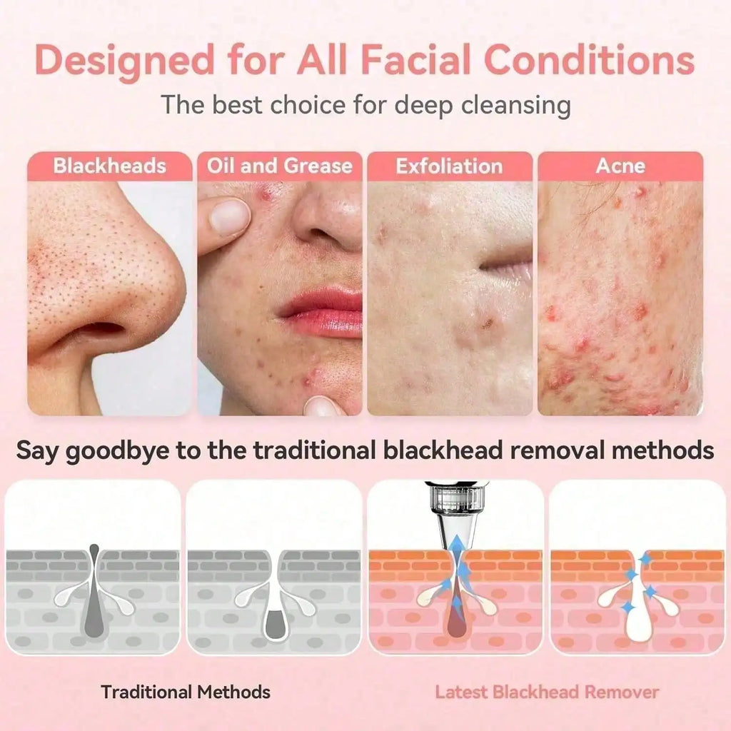 Zorivo™️ PureVac Pro.  (Zorivo™️ SkinClear Pro Luxury Pore Cleansing Device)