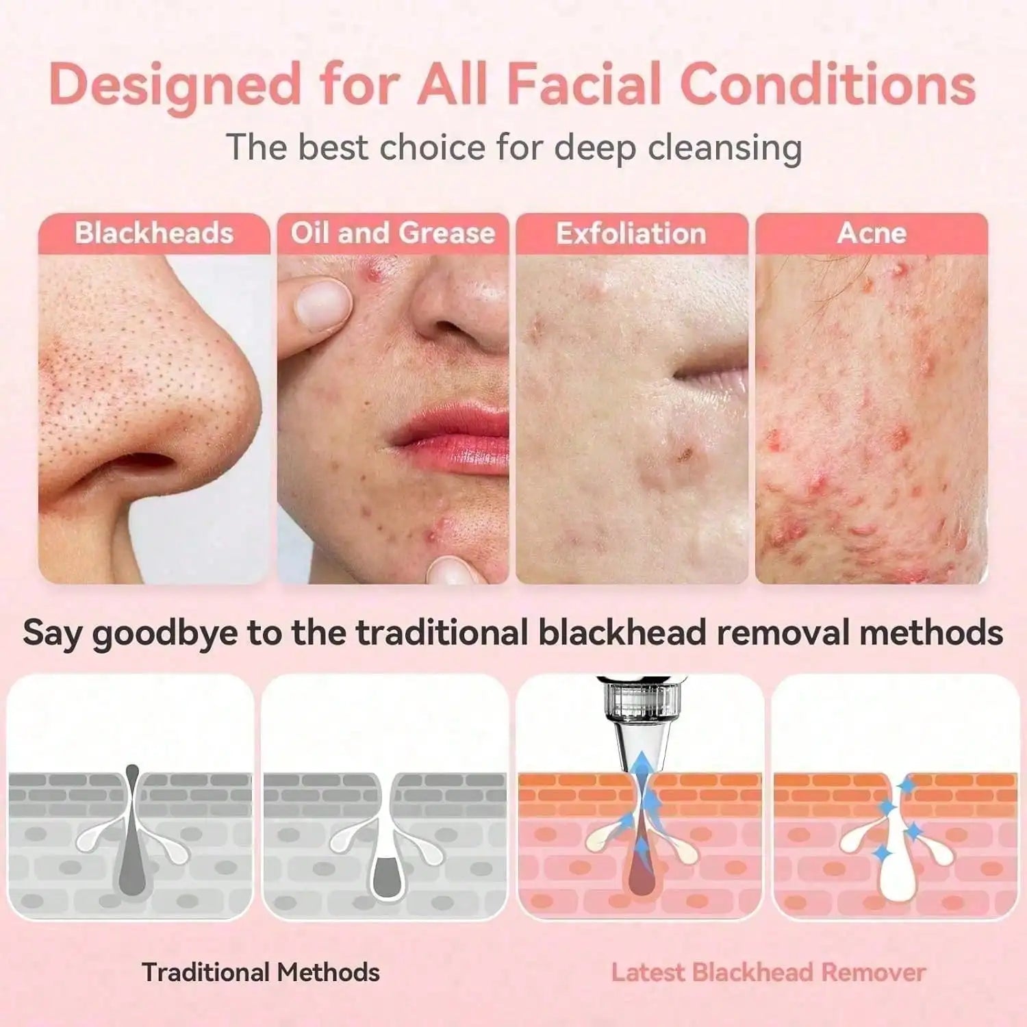 Zorivo™️ PureVac Pro.  (Zorivo™️ SkinClear Pro Luxury Pore Cleansing Device)